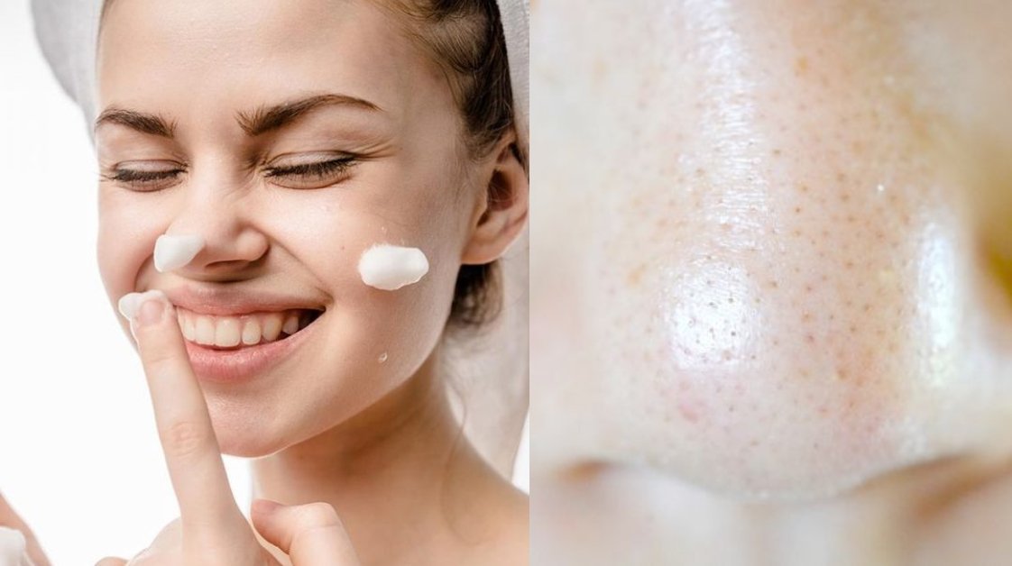 What Should I Do If My Pores Are Enlarged? | Lookhealthystore