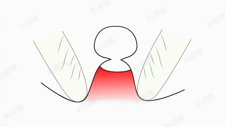 Can acne be squeezed on your face? | Lookhealthystore