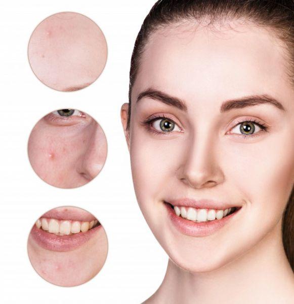 Share: Acne Skin Care Tips | Lookhealthystore