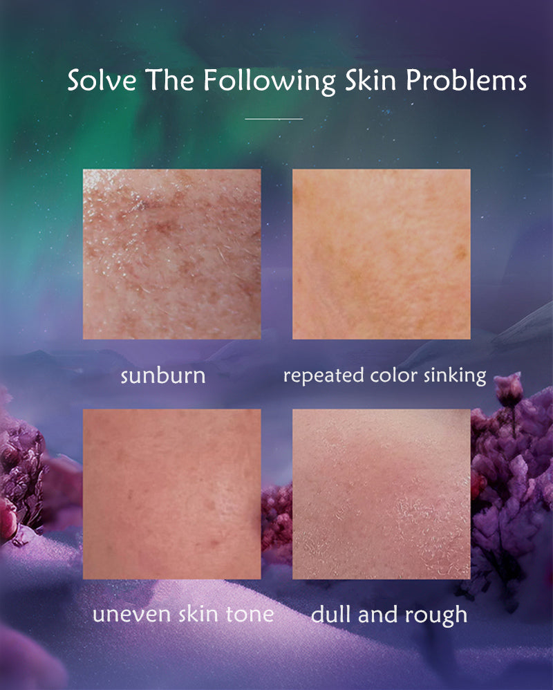 AFU Aurora Rose Whitening Concentrated Blemishes Essence Face Cream (2.0) T4004