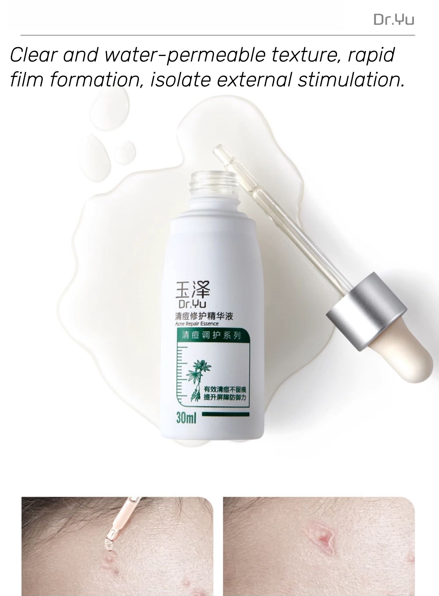 Dr.Yu Acne Repair Oil-control Moisturizing Essence Serum T4398