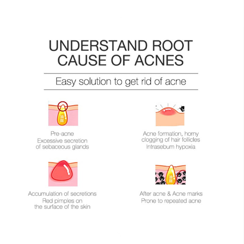 WINONA Acne Spot Treatment Invisible Anti-Acne Paste 18 PCS T3479