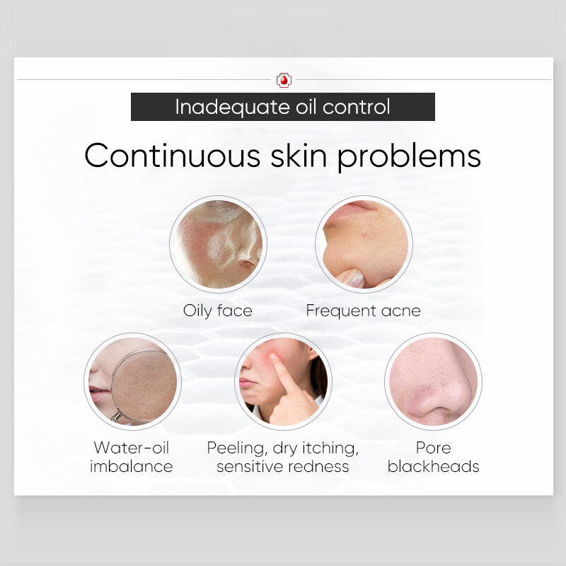 WINONA Oil-Control Series Relieving & Moisturizing Gel T2194