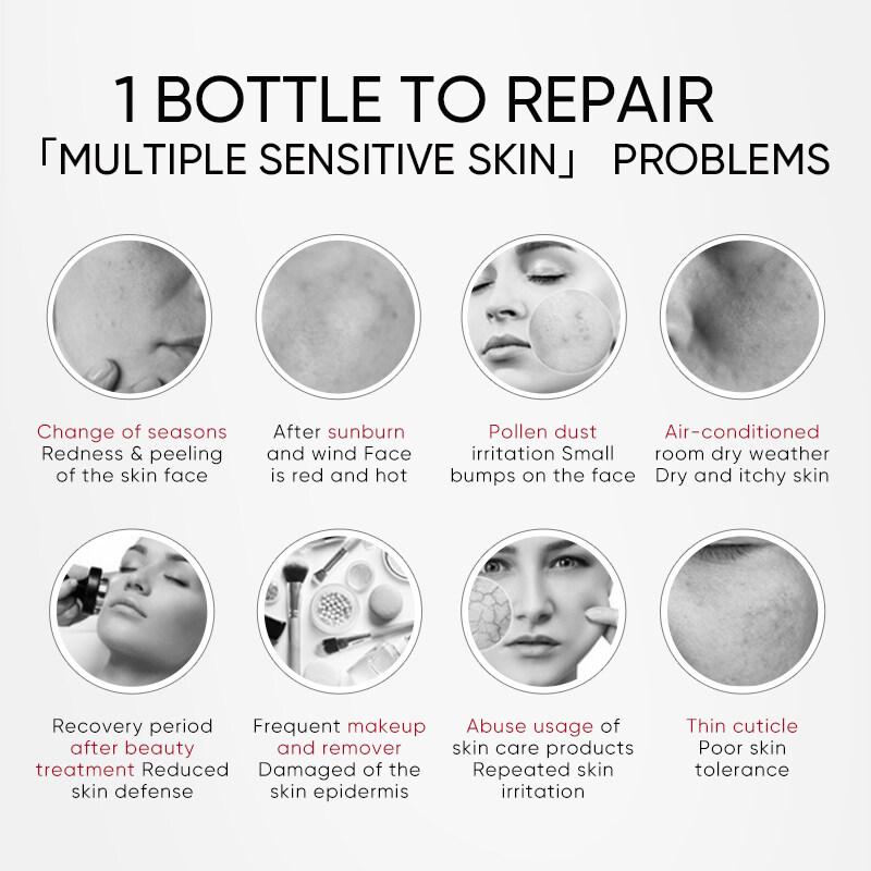 WINONA Anti-Sensitive Series Moist Tolerance-Extreme Face Cream (2.0) T2190