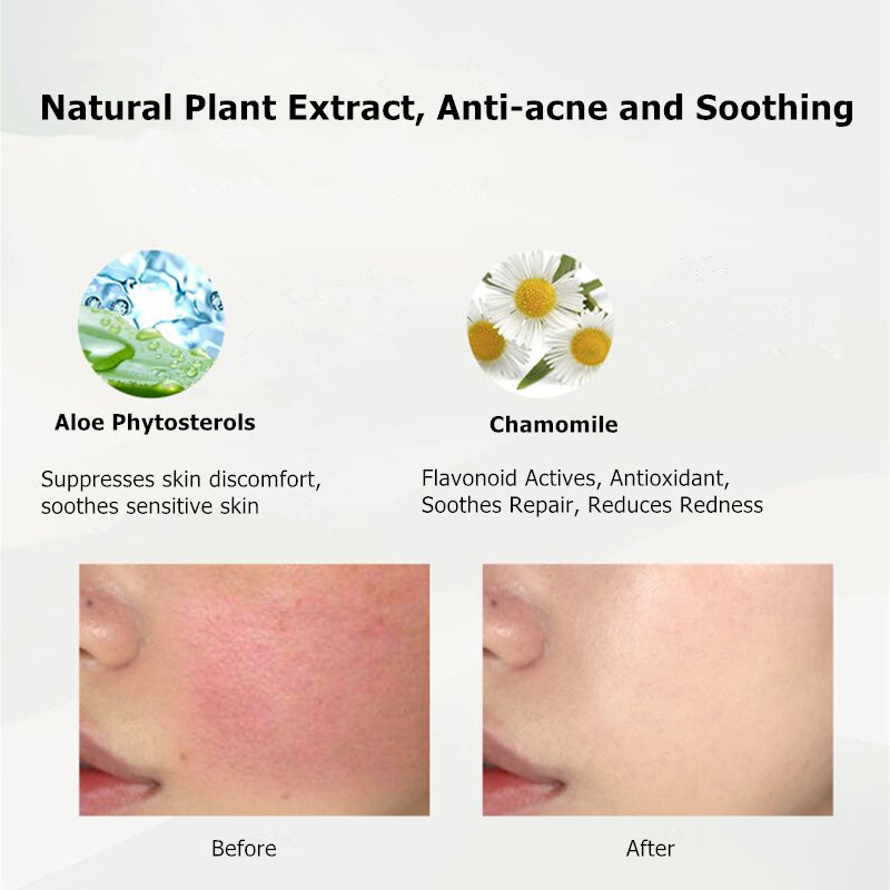 aloe vera plant for acne before and after RNW Organic 93% Hydrating Anti-acne Aloe Vera Gel 250ML T2875 – LookHealthyStore