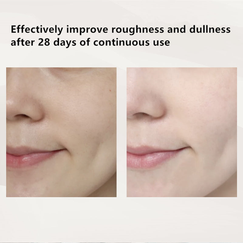 RNW Lactobacillus Fruit Acid Exfoliating Mild Peeling Gel 150ML T2879